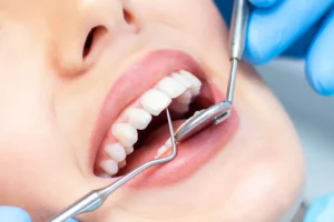How Micro-Invasive Dentistry Preserves Natural Tooth Structure for Life